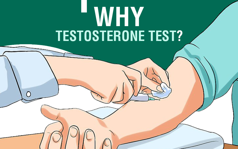 Testosterone Test 