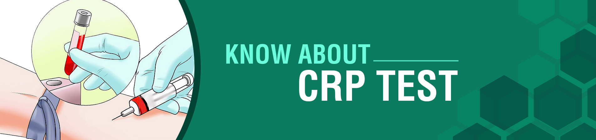 CRP test cost in Kolkata