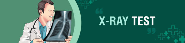 x ray in kolkata