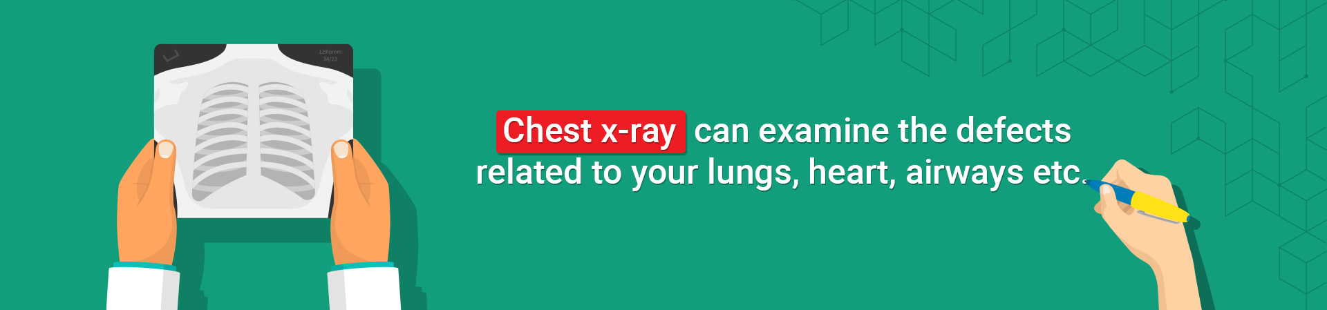 chest x ray in kolkata