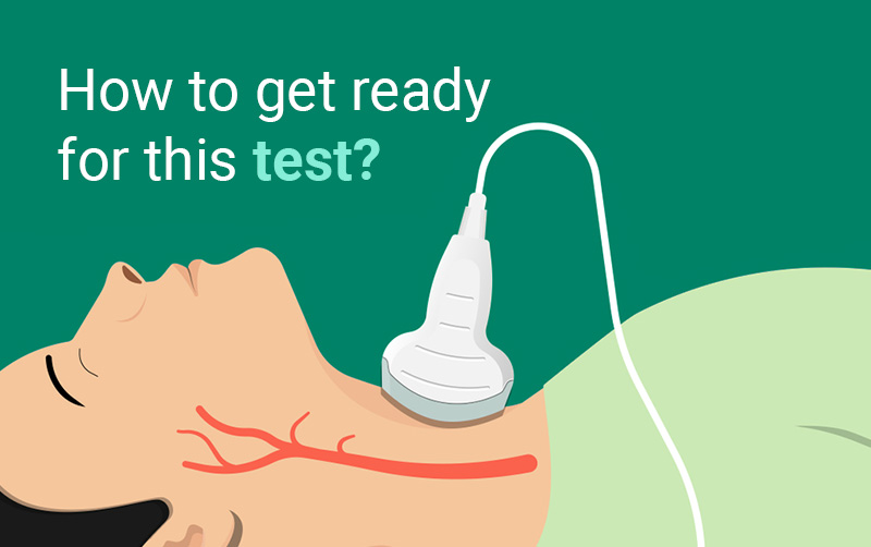 carotid doppler test