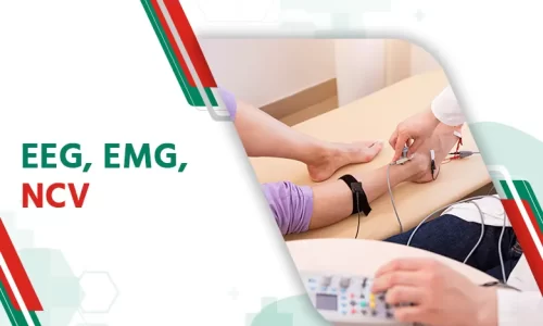 AH Section_2 Nerve Test Baruipur