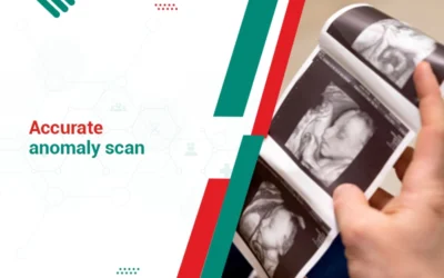 Accurate Anomaly Scan