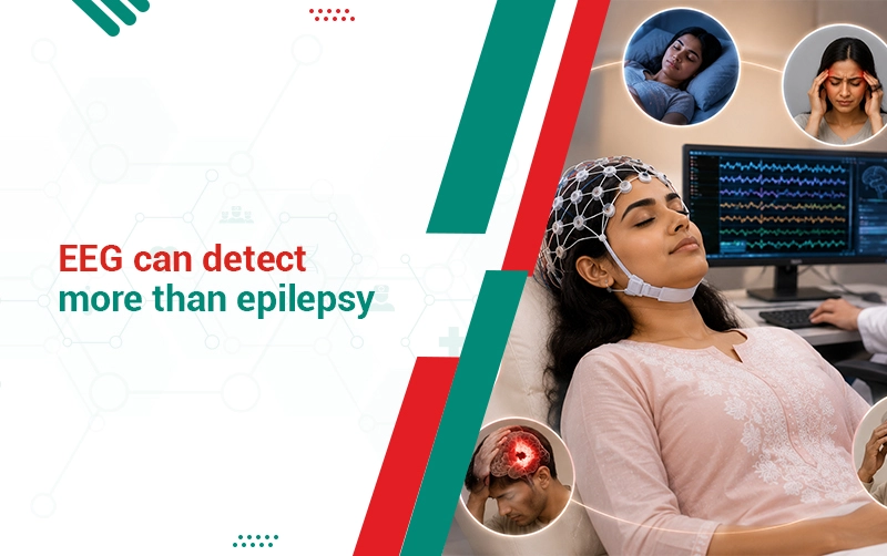 EEG Can Detect