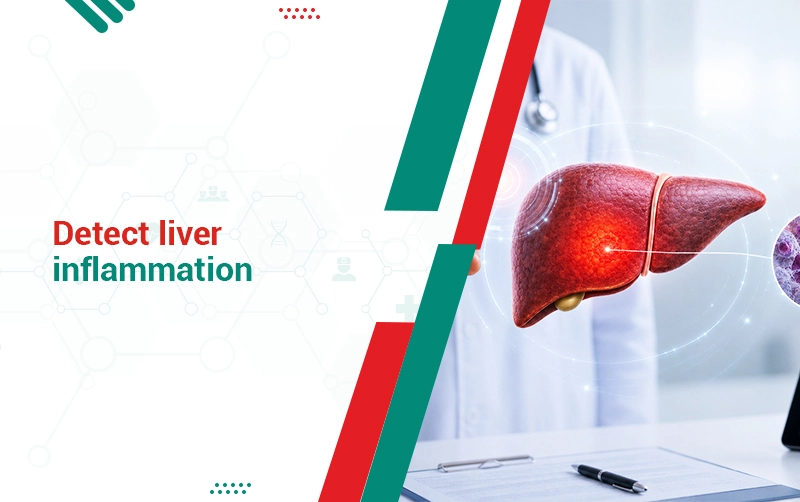 Section 1 Detect Liver Inflammation
