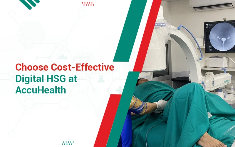 Section 2 HSG Cost